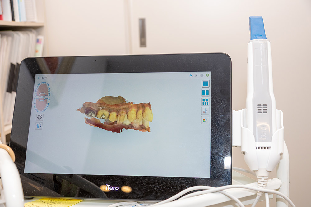 デジタルスキャナー