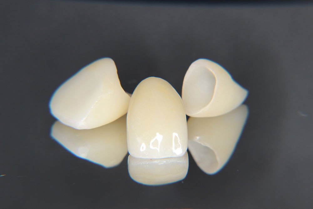 ジルコニアセラミック